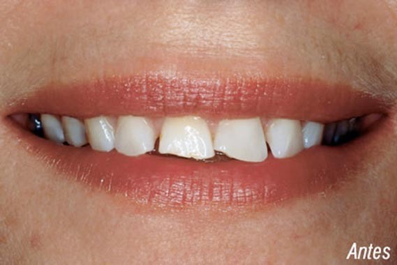 Estado previo al tratamiento dental